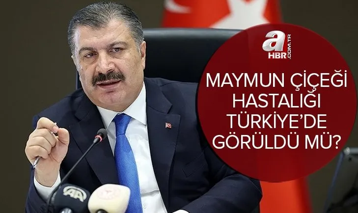 Maymun çiçeği virüsü Türkiye’de var mı? Sağlık Bakanı Fahrettin Koca açıkladı! Maymun çiçeği hastalığı belirtileri nedir?