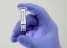 Yerli korona aşısının yan etkileri var mı?