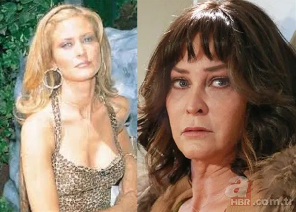 Ünlü isimlerin değişimi görenleri şaşırtıyor 17