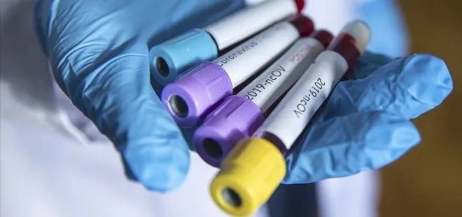 Türkiye Kolombiya’ya 26 bin koronavirüs tanı testi gönderdi