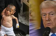 Trump'tan Gazze'de açlıktan ölen çocuklara ilişkin açıklama: Görüntüler korkunç