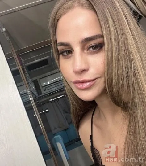 Büşra Pekin’de estetikle yeni birine dönüşenler kervanında! 1 estetiğim var deyince ti’ye alınmıştı… 4 bantla o hale gelmiş! 12