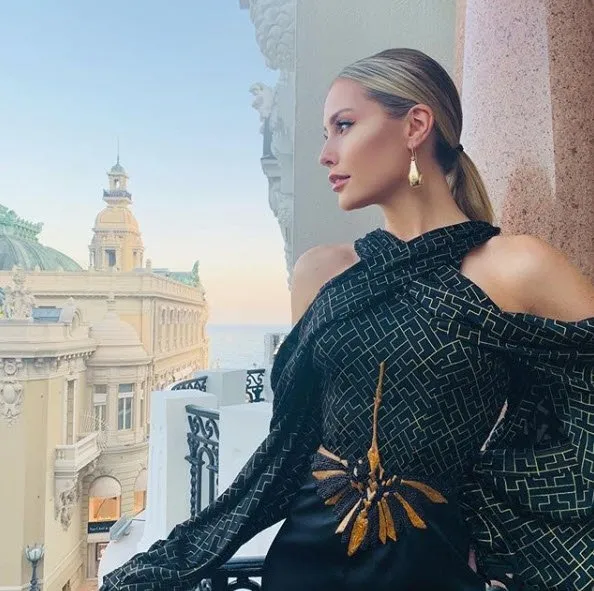 Serdar Ortaç'ın eski eşi Chloe Loughnan estetikten tanınmaz hale geldi!