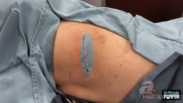 30 yıl boyunca baş ağrısıyla yaşadı! Nedeni şoke etti... 136