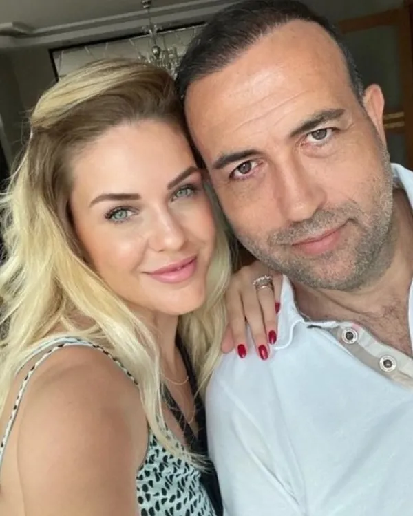 Emine Ün’ün eski kocası Tolga Karakaş yaptırdığı estetiklerle 10 yaş geriye gitti