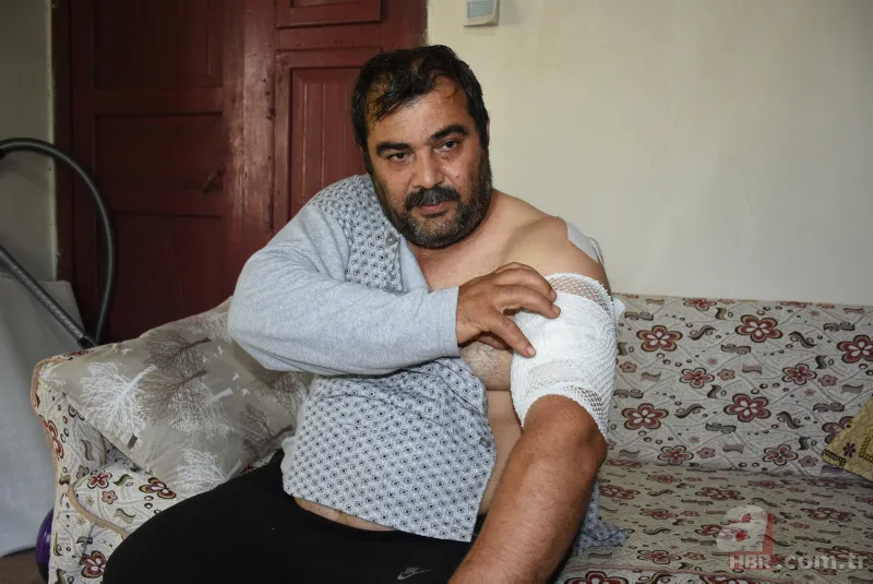 Bartın'da ayı saldırısı! 65 dikiş atıldı: Öldüğümü sanıp bıraktı 1