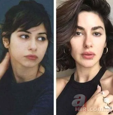 Bir Zamanlar Çukurova’nın Gülten’i Selin Genç de estetik harikası çıktı! Eski hali şoke etti 18