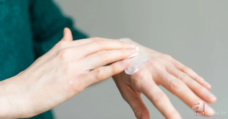 Kuruluğa, kızarıklığa ve acıya son! Eldeki kaşıntı ve egzamayı rahatlatacak yöntem! Tek damlasını sürünce... 2