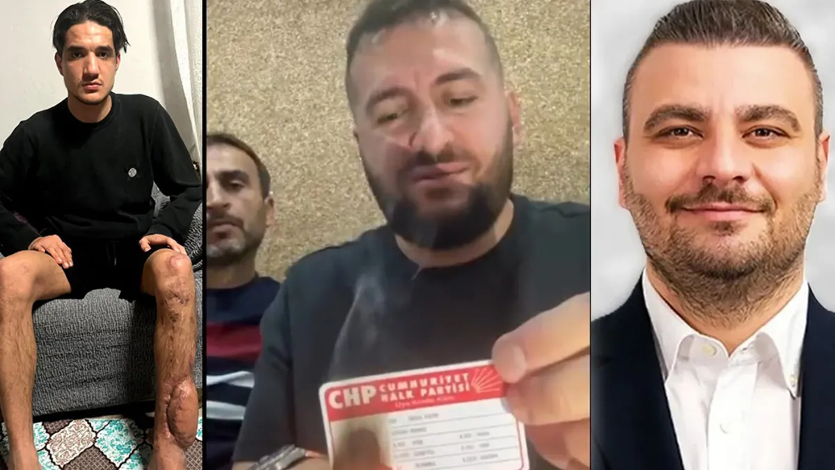 CHP ilçe başkanının çarparak sakat bıraktığı genç olayının perde arkası! O genç sadece A Haber’e anlattı!