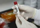 Ukraynadan korona aşısı açıklaması