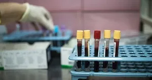 Türk bilim insanları keşfetti! Kanserle savaşta önemli bulgu