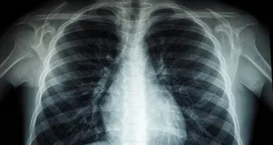 Nasıl olsa geçer demeyin! Bu belirtiler kanserin habercisi olabilir