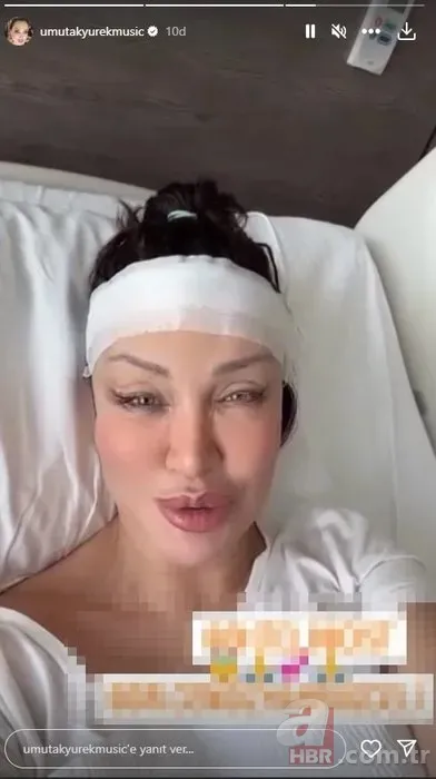 Böylesi görülmedi! Umut Akyürek bakın neresine estetik yaptırdı 7