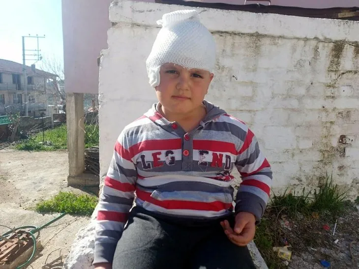 İzmir’de pitbull dehşeti! Sevmek isterken hayatının şokunu yaşadı | 6 yaşındaki Çınar kabus dolu anları anlattı