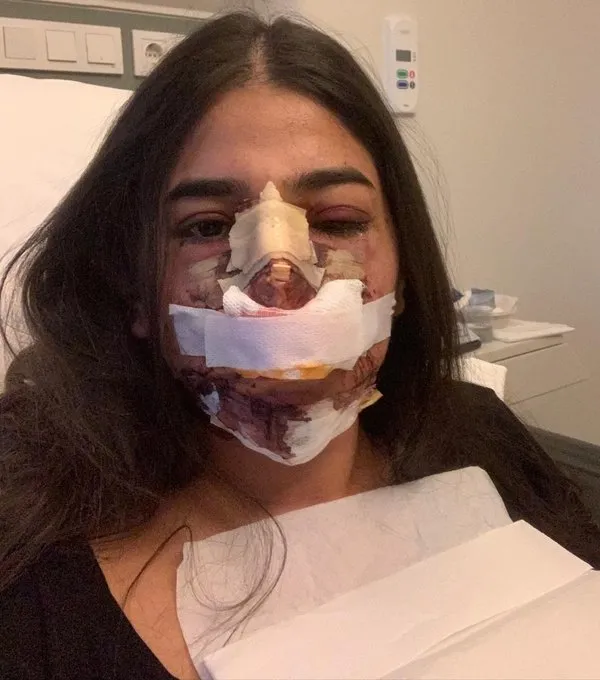 Estetik faciası evlilik arifesindeki kızı hayata küstürdü - 8