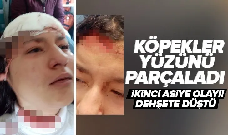 Asiye Ateş olayı sıcaklığını korurken bir kötü haber de Kastamonu’dan geldi! Sokak köpekleri genç kızın yüzünü parçaladı
