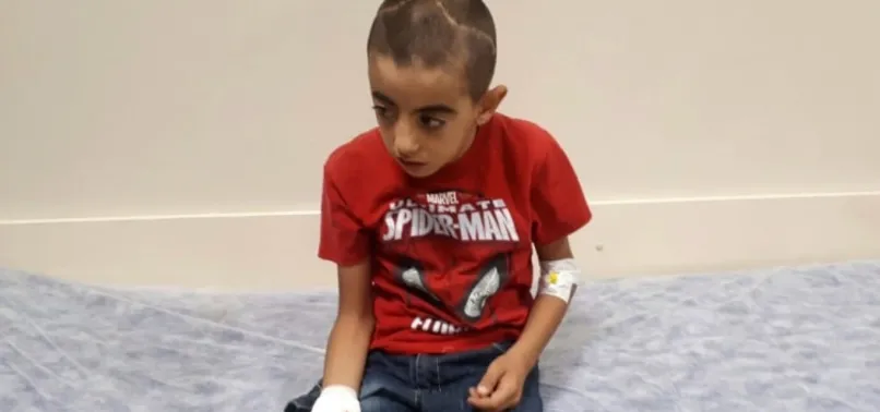 9 yaşındaki çocuğun eline şiş saplandı