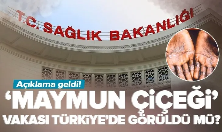 Türkiye’de maymun çiçeği vakası görüldü mü? Açıklama geldi
