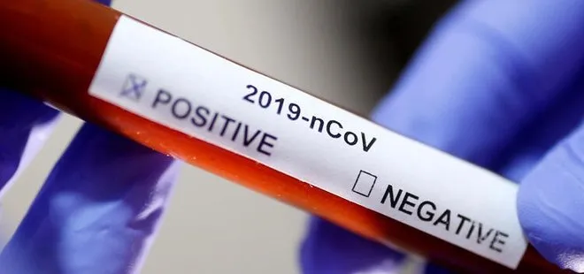Arap ülkelerinde koronavirüs kaynaklı can kaybı ve vakalar artıyor