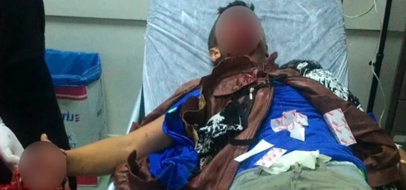 Polise atmak istediği bomba elinde patladı