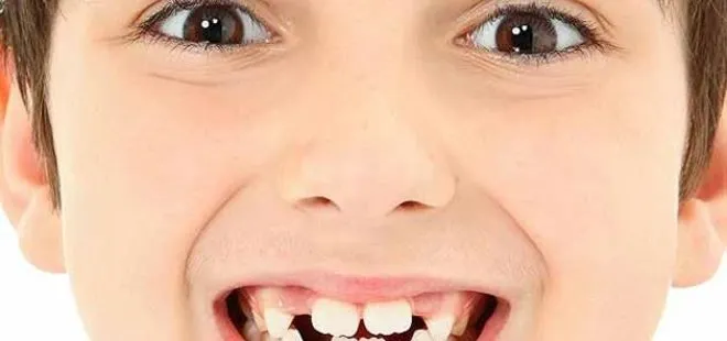 Çocuklarda ayrık diş normal