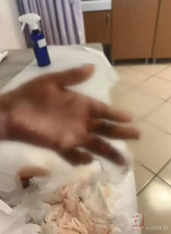 Kuaförde korkunç olay! 14 yaşındaki çocuğun tüm vücudu yandı 5