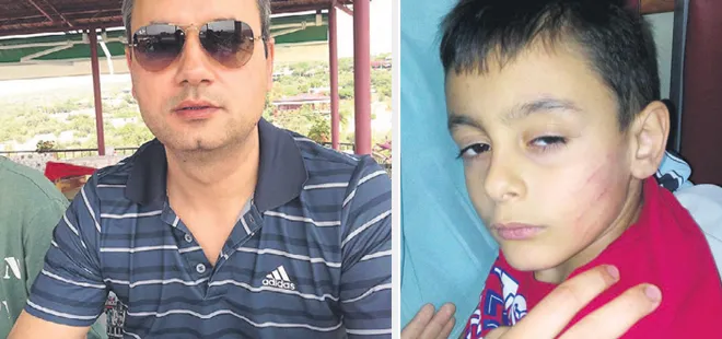 Doktordan sünnet dayağı