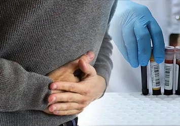 Bu kan grubunda olanlar dikkat! Mide kanseri olma riski yüksek...