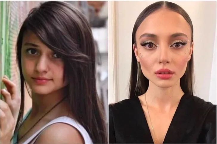 bir zamanlar cukurova nin mujgan i melike ipek yalova estetiksiz haliyle soke etti