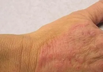 Rutubetli ortamlarda mantar tehlikesi!