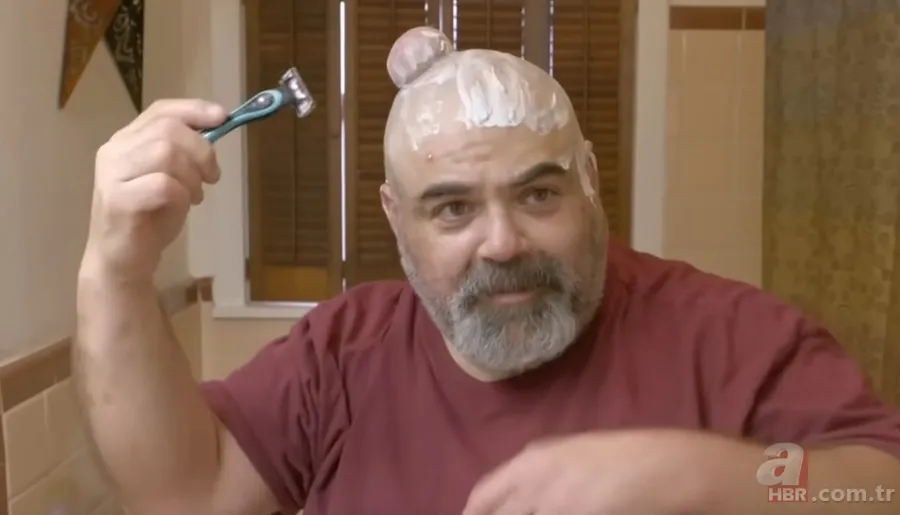 Sokağa şapka ile çıkıyordu! Başındaki şişlikten bakın ne çıktı 👩⚕️ Görenleri şaşkına çeviren olay 19