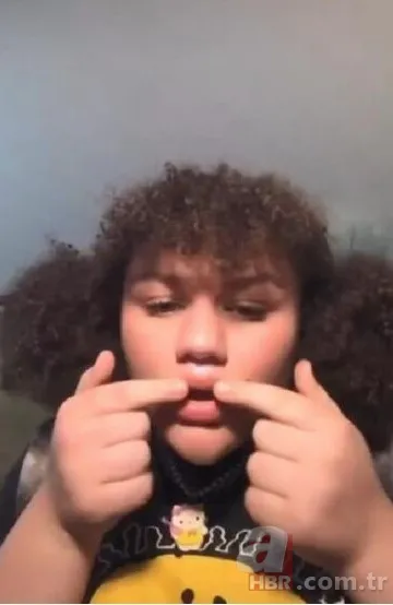 Fatih’te estetik yaptıran Bulgar modelin hayatı kabusa döndü! ‘Örümcek ağı’ operasyonu bakın ne hale getirdi? 14