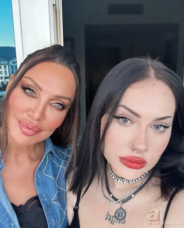 Böylesi görülmedi! Umut Akyürek bakın neresine estetik yaptırdı 13