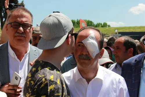 Edirne belediye başkanına saldırı - 1