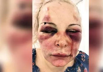 Otel odasında kabus! Otteva Elvira'nın anlattıkları kan dondurdu