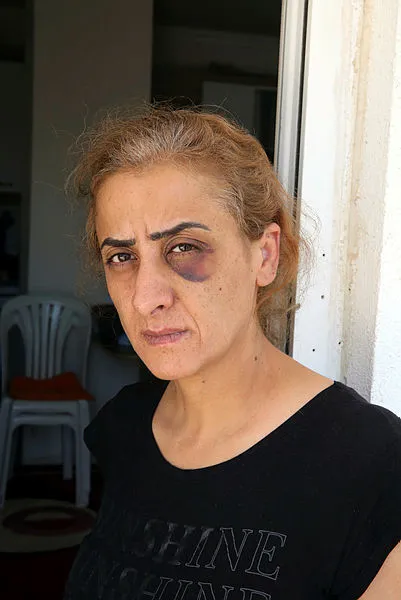 antalyada-yasayan-dilek-goktasin-yardim-cigligi-hayatim-kabus-oldu-olmek-istemiyorum-1623130825929.jpg Antalya’da yaşayan Dilek Göktaş’ın yardım çığlığı: Hayatım kâbus oldu ölmek istemiyorum - 2