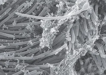 Dikkat çeken araştırma: Koronavirüs vücudu böyle işgal ediyor!