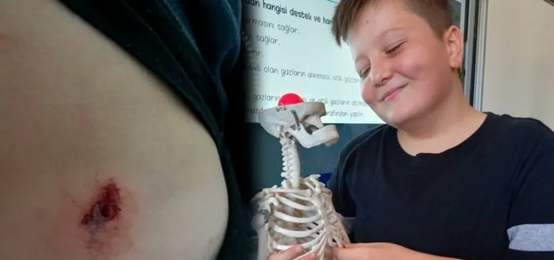 Denizli'de korkunç olay! Yorgun mermi 12 yaşındaki çocuğa kabusu yaşattı