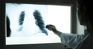 Uzmanı uyardı: KOAH’lı hastaların uzak durması gereken yiyecekler...