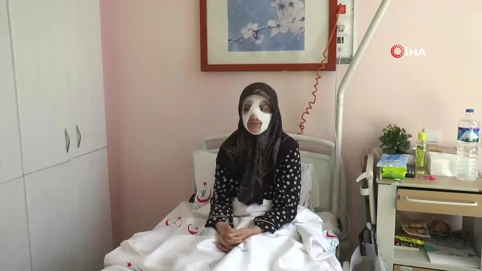 Patlayan düdüklü tencere hastanelik etti