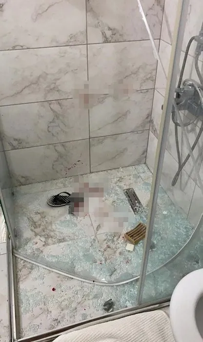 Ankara'da vahşet! Güzellik uzmanı Rus eşini öldüresiye dövdü - 4