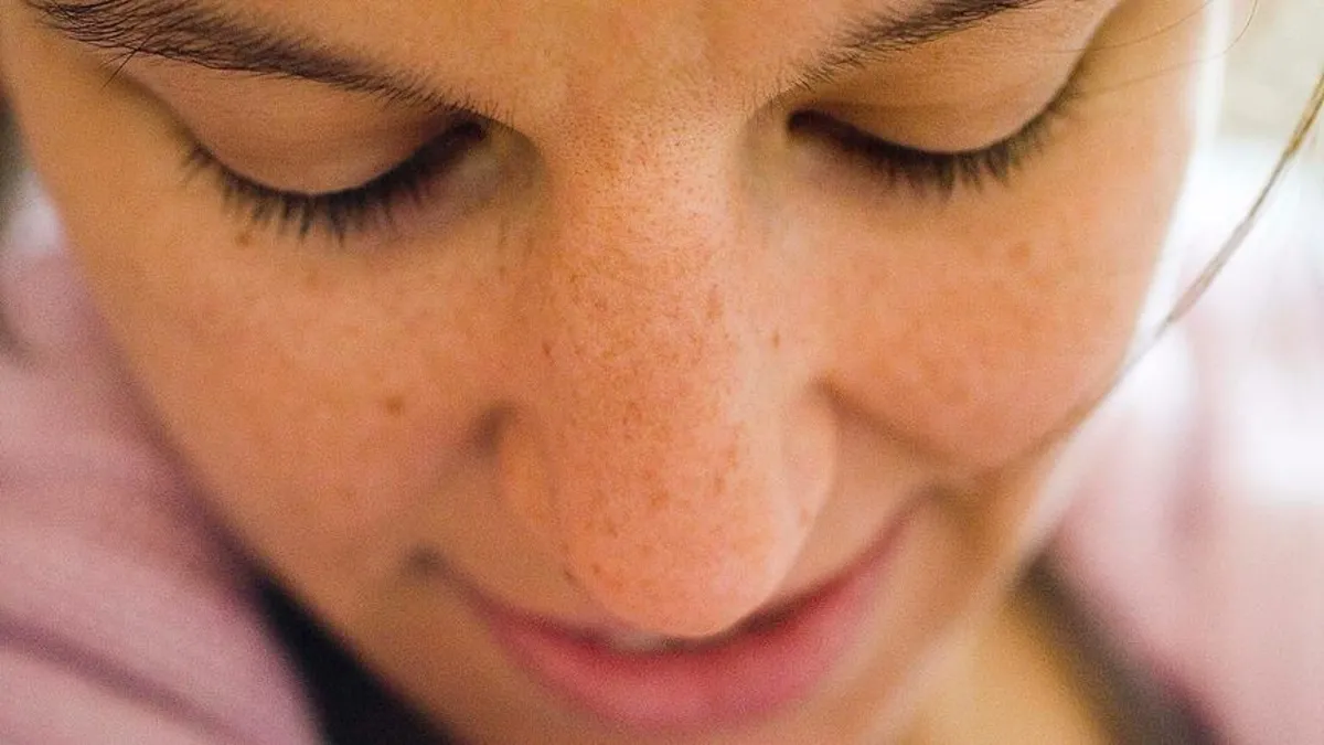 Uzmanından uyarı: 'Ben'ler sadece cerrahi yolla alınmalı