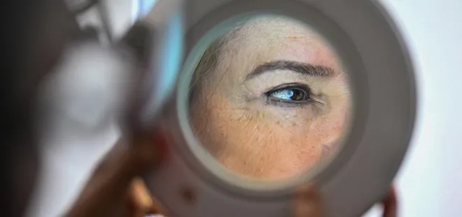 Türkiye’de cilt kanseri vakaları hızla artıyor!