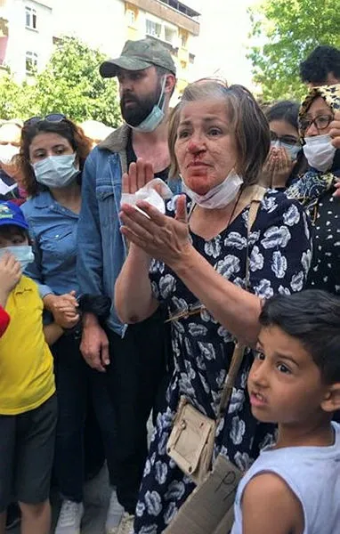 CHP’li İmamoğlu'nu protestoda yerlerde sürüklenen Ayşe Topçu'nun oğlu: İmamoğlu kapıyı açarak araç kapısıyla anneme vurdu - 2