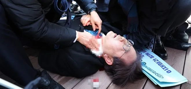 Güney Kore’de ana muhalefet liderine saldırı: Boynundan bıçaklandı