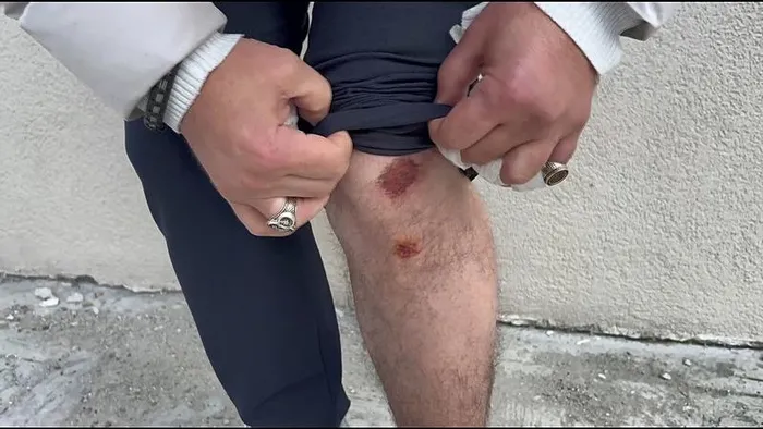 esenyurtta-basibos-kopek-dehseti-yolda-gecenlere-saldirdi-onlem-alinmasi-icin-eslem-gibi-birinin-olmesi-mi-laz-1737474124280.jpeg (Foto: DHA)