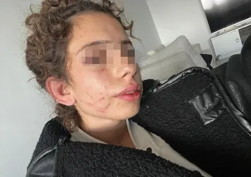 Konya'da korkunç olay! 19 yaşındaki genç kızı öldüresiye dövdü