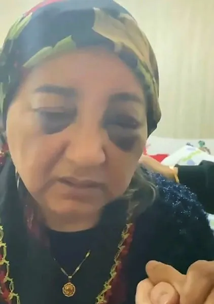 Kocaeli'de eşini dövüp 2 boyunca aç ve susuz bırakan cani koca tutuklandı - 3