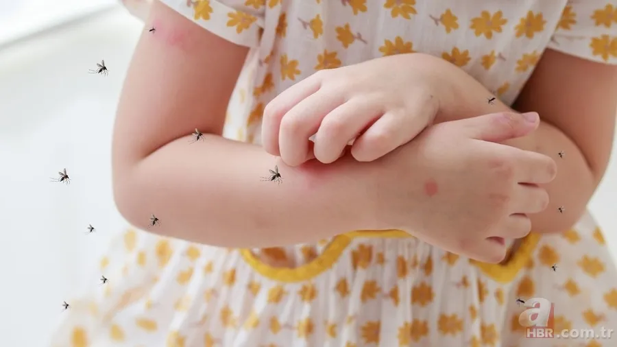 Çin’de virüs alarmı: Chikungunya virüsü nedir? Chikungunya hastalığı nasıl bulaşır, belirtileri neler, tedavisi mümkün mü? 7