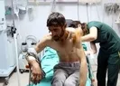 Ayı dehşeti! Bakın nasıl hayatta kaldı